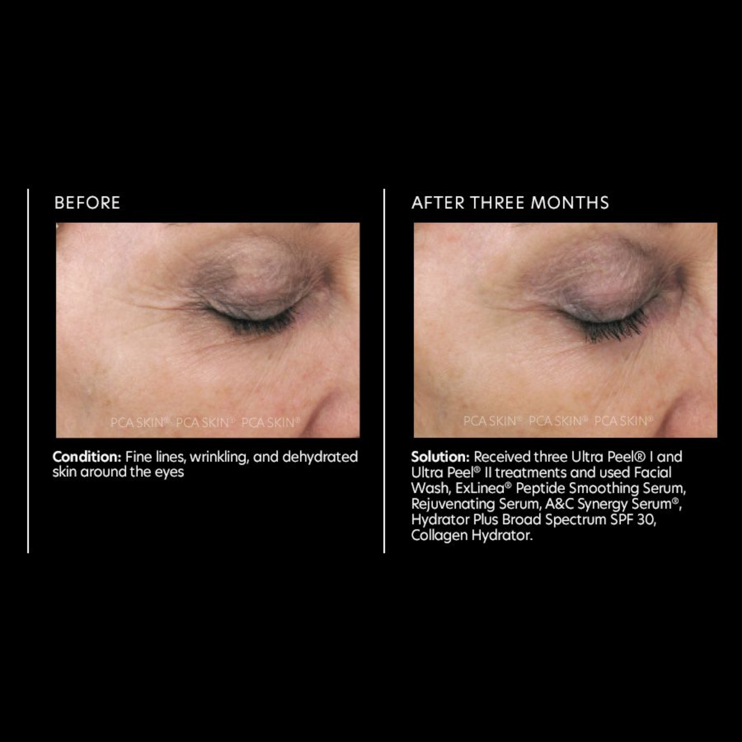 Rejuvenating Serum | PCA Skin
