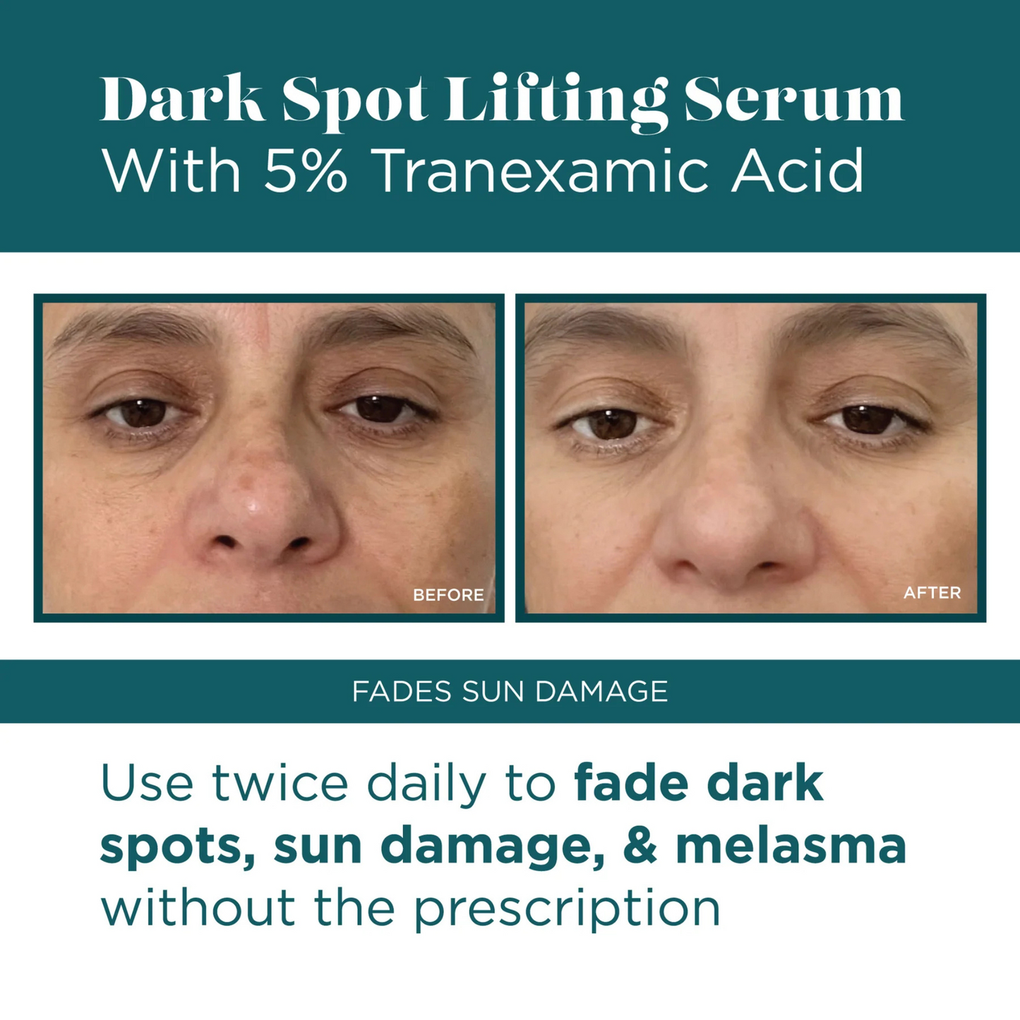 Dark Spot Lifting Serum with 5% Tranexamic Acid | VI Derm