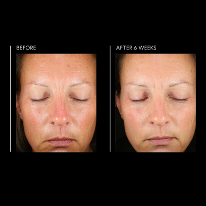 Hyaluronic Acid Overnight Mask | PCA Skin