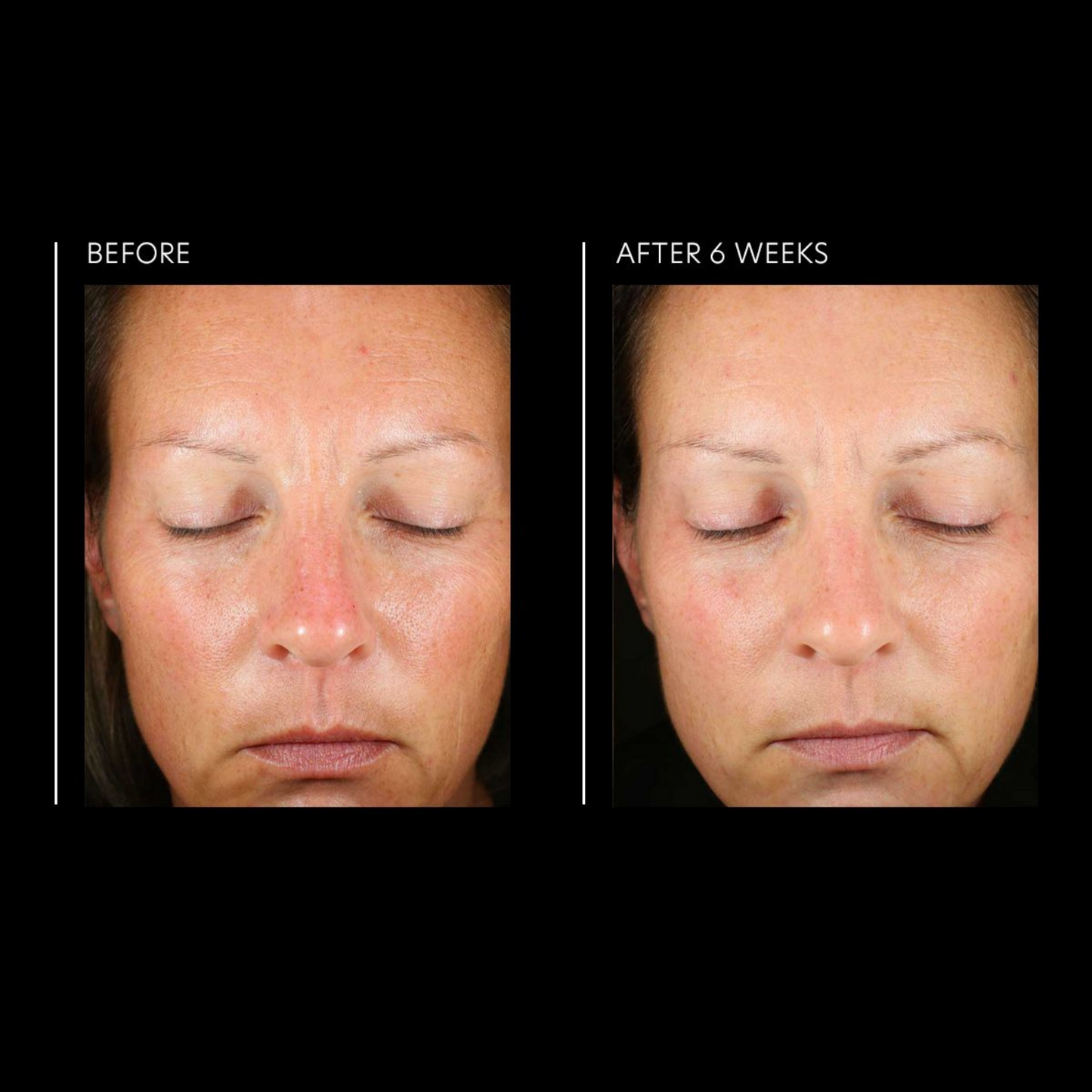 Hyaluronic Acid Overnight Mask | PCA Skin