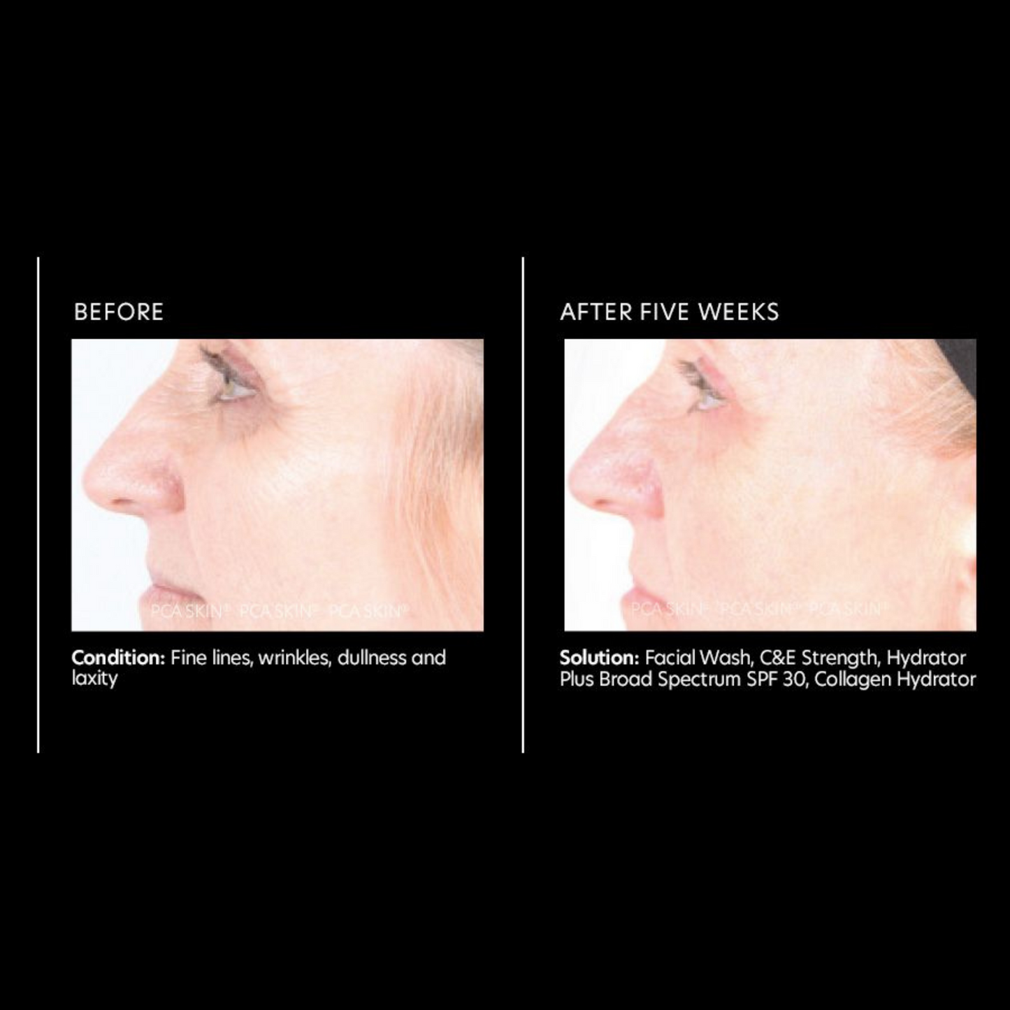 C&E Strength Max | PCA Skin